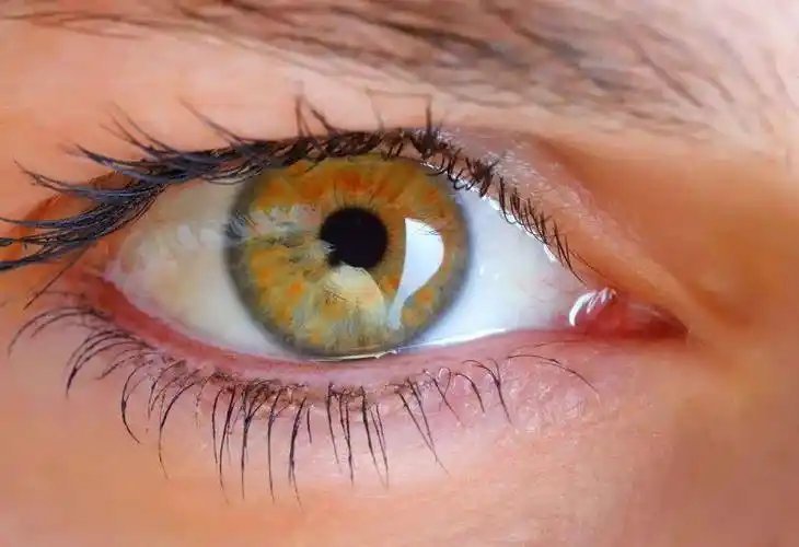 为你摘星,还你明眸(25)眼睑你所不知道的秘密_手术