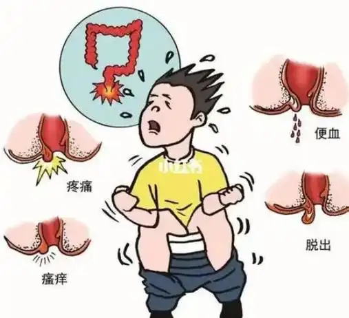 痔疮是什么样子的?