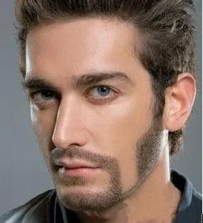 鬓角种植塑造完美有型男人