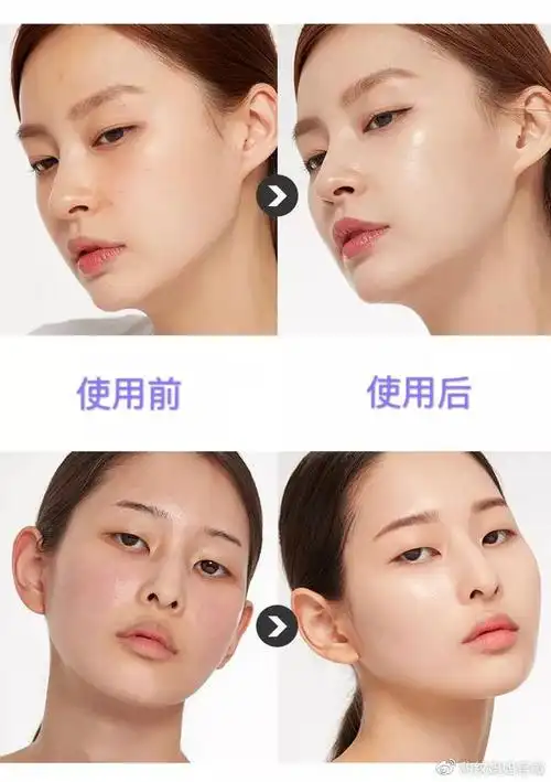 皮肤干燥会引起哪些问题?