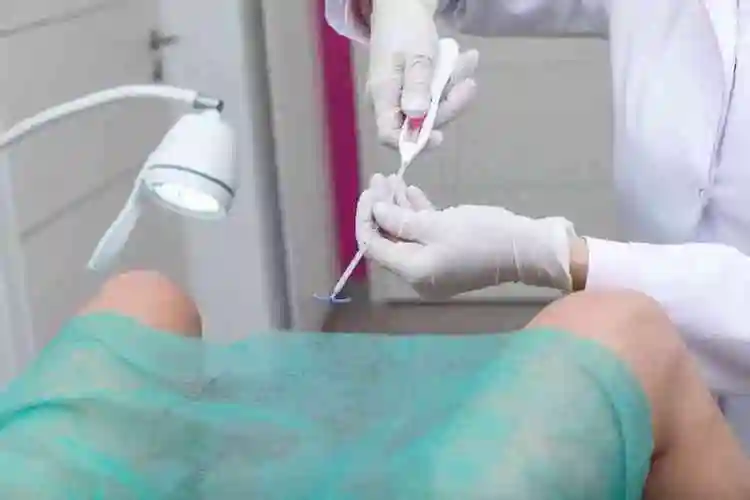 光明磊落! 取避孕环 "鱼水相亲"-第2张图片-方波博客