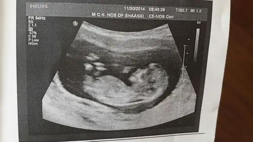 上面个女宝,下面个看不清宝妈给我看看吧