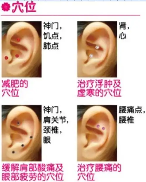 人体结构经络穴位耳穴对治疾病彩图