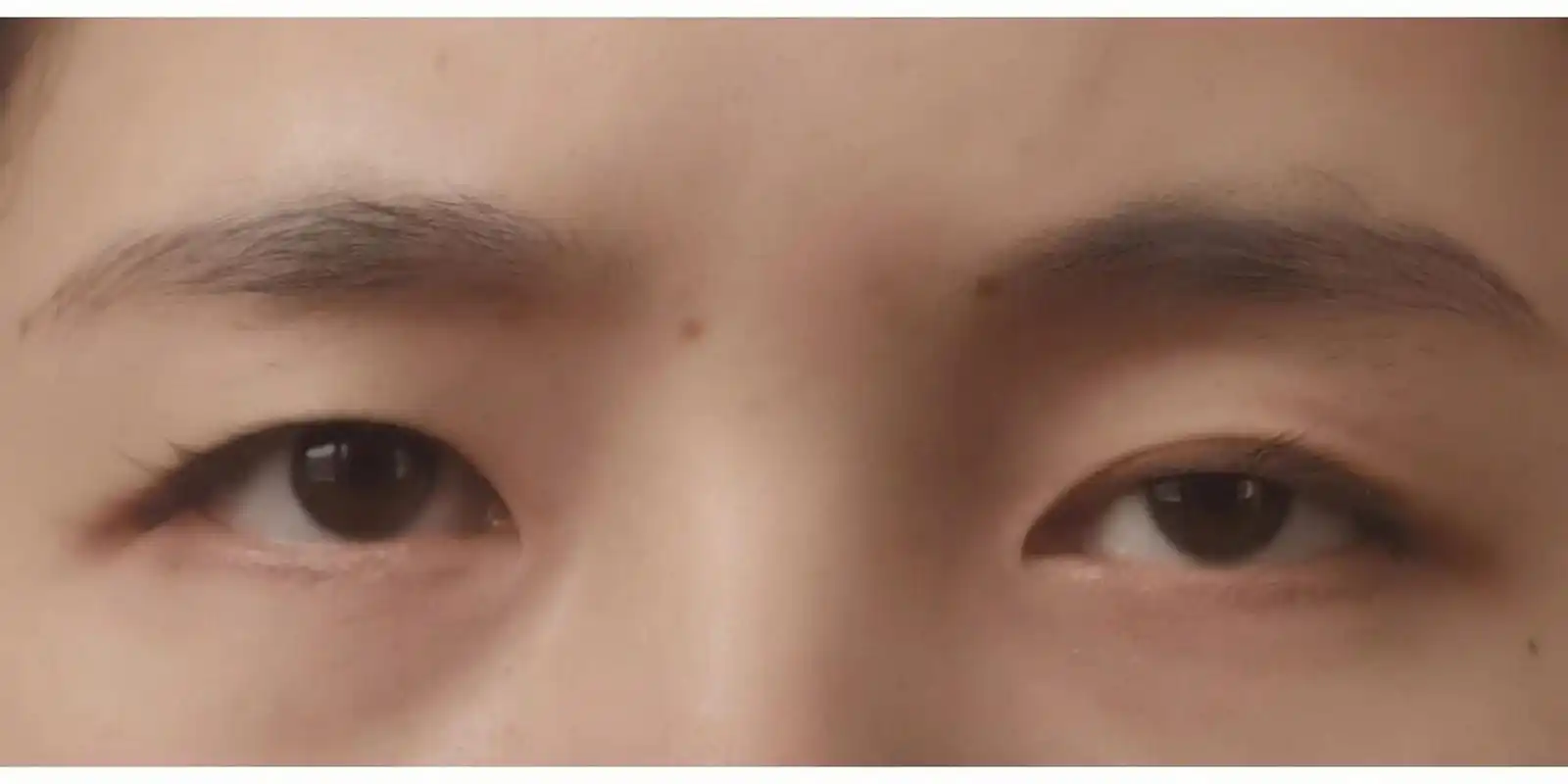 眼睑肌无力 姐妹们,请问这是肌无力吗,眼睛不使劲就不能全睁开,有什么