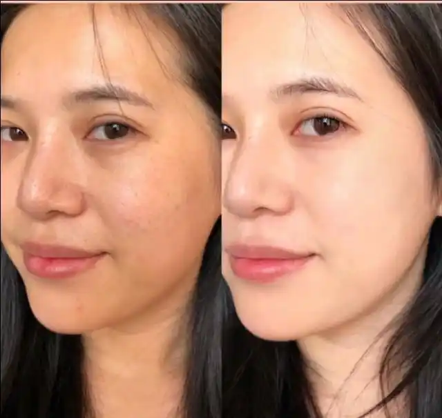 你的护肤品如果含有这些成分,千万不要一起用,烂脸cp了解一下