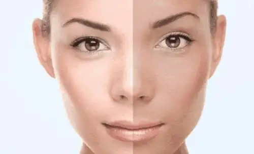 吸烟者可通过"拇指"看出肺部的好坏.