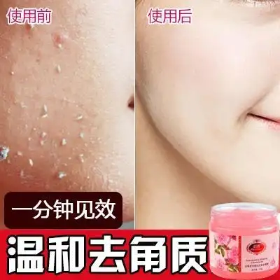 去角质 去死皮 啫喱面部男女全身温和全身体磨砂膏美白补水鸡皮肤