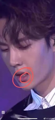 还有粉丝投给壹姐去年12月28日星光大赏肖战王一博嘴唇肿了是不是吻痕