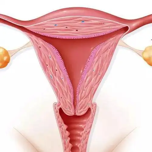 科普这些子宫高危疾病防不胜防还容易导致不孕引发早产流产