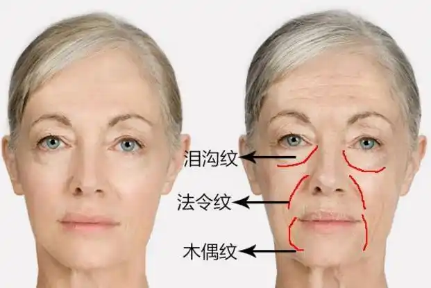 你是不是正在衰老!