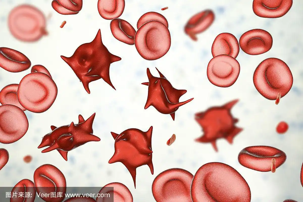 棘细胞,有刺状突起的异常红细胞