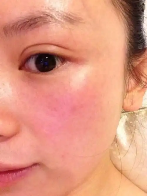 怎么修复敏感肌手把手教你一个超实用的修复方法