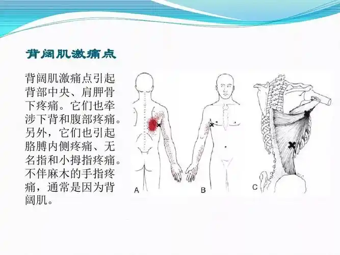 肩背肌筋膜炎的诊断及手法治疗概况