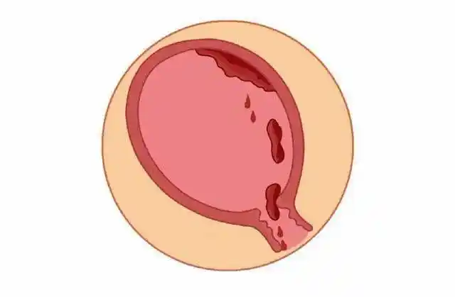 残留_颜色_白色