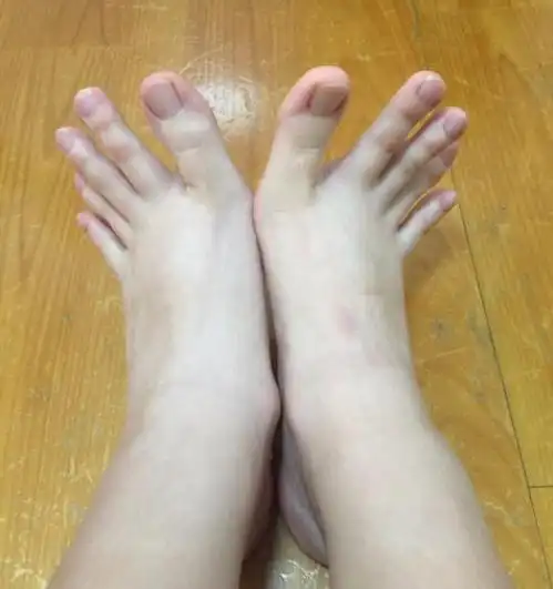 这个女大学生的脚很多人看了都说很奇怪