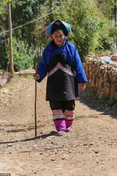 实拍最后的"裹足老人" "三寸金莲"脚掌已变形