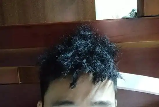 烫头烫坏了怎么办兄弟们