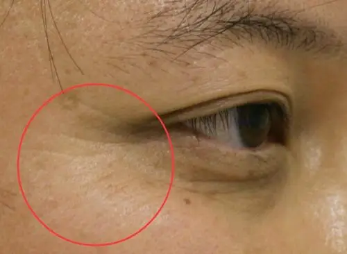 药店仅一元的液体,睡前兑水涂一涂,一周抚平皱纹皮肤白嫩显年轻