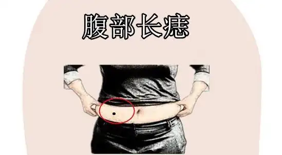 身上5颗"皇帝"痣,有车有房,有财有势,儿女双全,婚姻幸福!