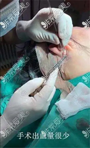 太原哪里做拉皮手术好效果来看太原抗衰除皱这5家口碑出色