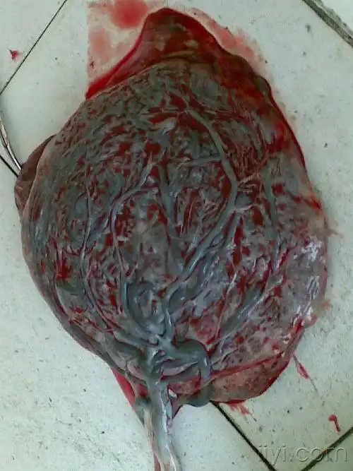 胎盘能不能吃真的大补吗