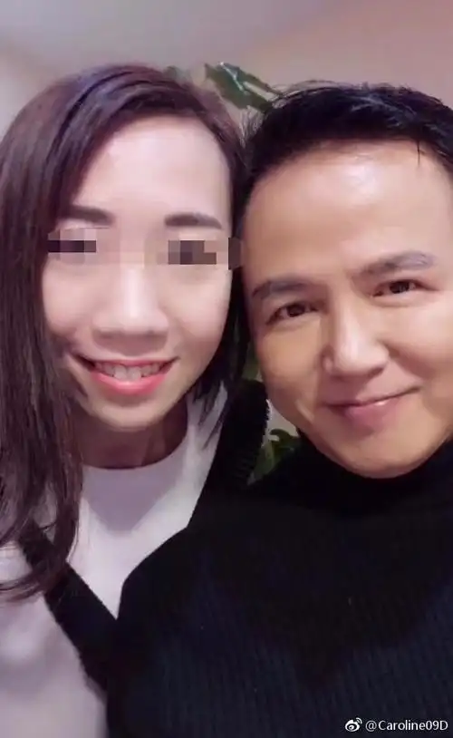 张庭老公林瑞阳染黑发,颜值重回巅峰