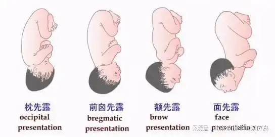 妇产科护理学虚拟仿真软件带你了解持续性枕横位分娩机制|胎位|胎头