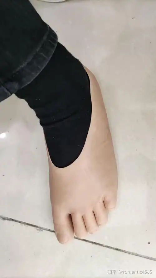 半足假肢主要对理想残肢有好的效果,脚底受力面有植皮,残肢有较大的