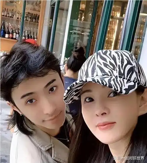 秦昊妻子韩国打水光针,伊能静56岁满脸针眼,感慨:实在太痛苦了