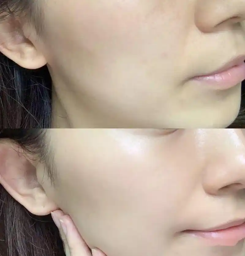 4吸收效果加倍这款美白小奶瓶不仅成分讲究,技术也很厉害,采用了dds