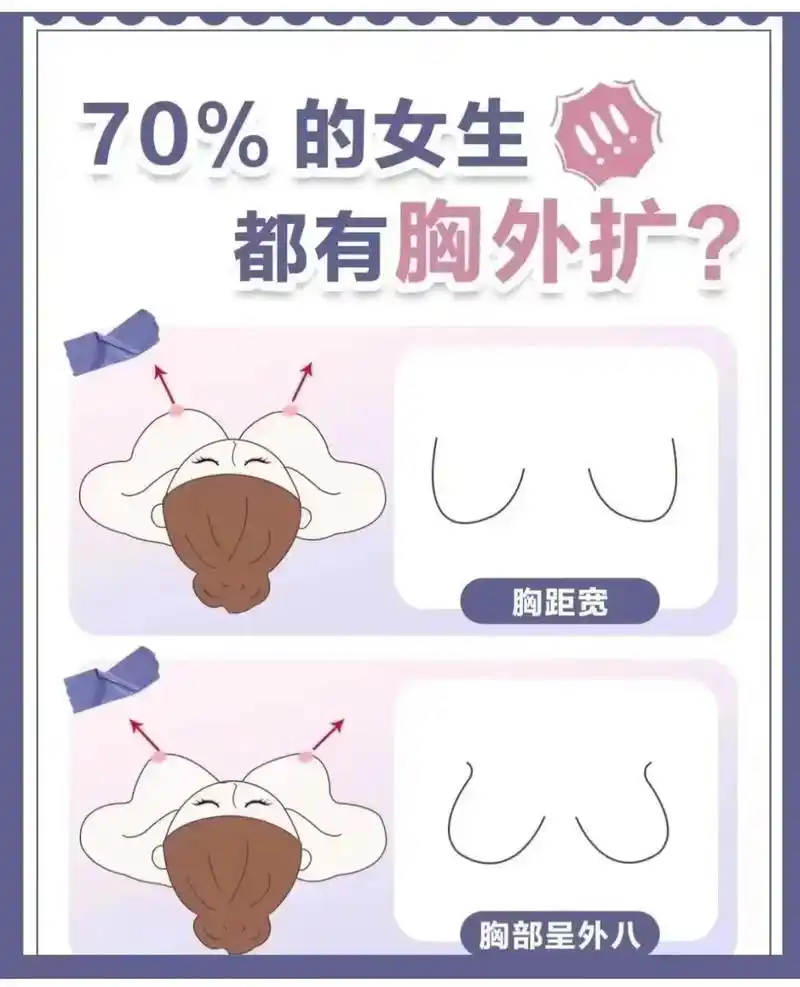 丰胸 好多女生都有胸外扩,你有吗? #科普 #抖音图文来啦 - 抖音