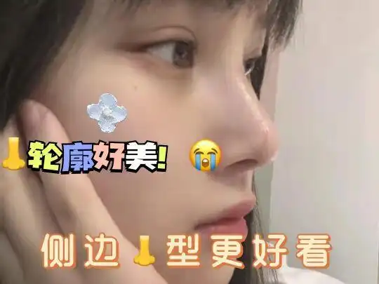 玻尿酸垫鼻子多少钱_小红书