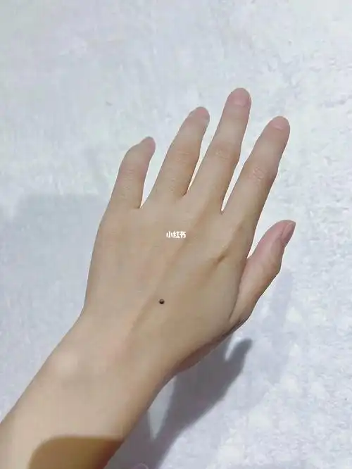 真的第一次见到有人跟我一样手背有一颗痣