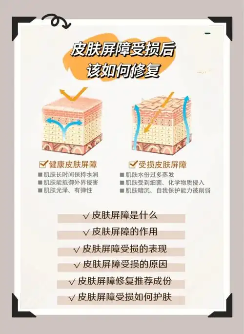 皮肤屏障受损有哪些表现受损后该如何修复