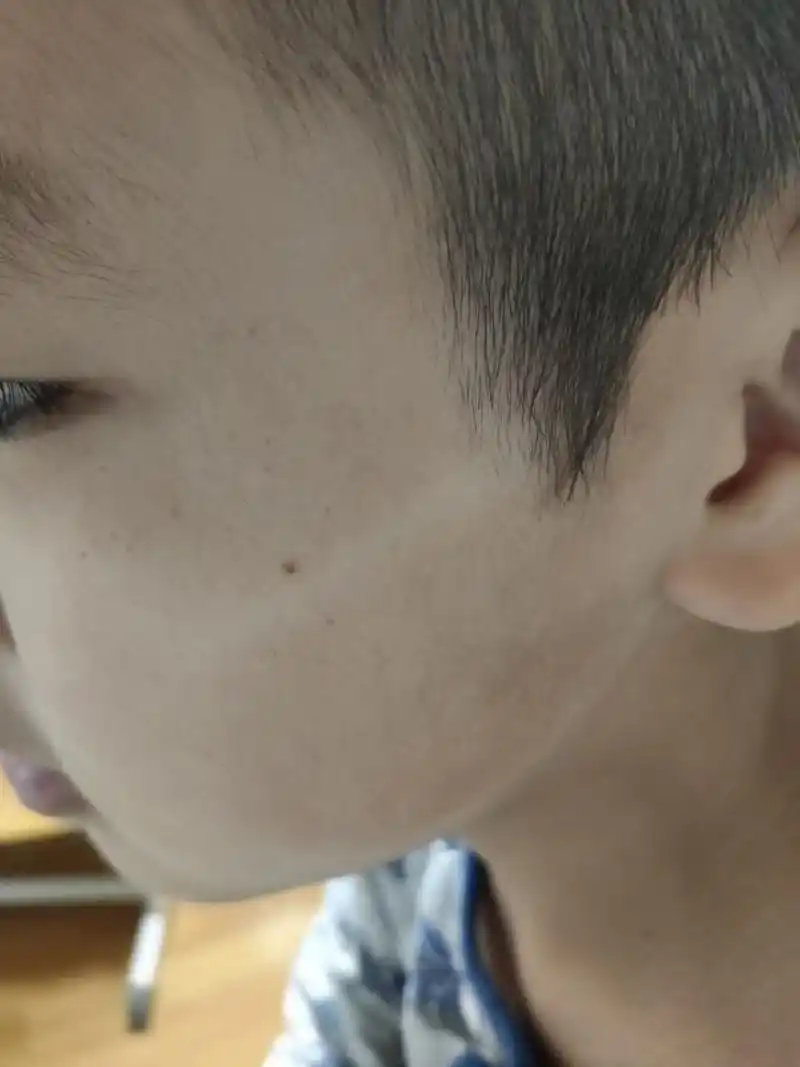 论 防晒的重要性 小学生天天戴口罩上学 我觉得孩子们还是很棒的 每天