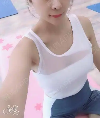 乳房下垂矫正术后36天_假体隆胸术后36天_胸型美化