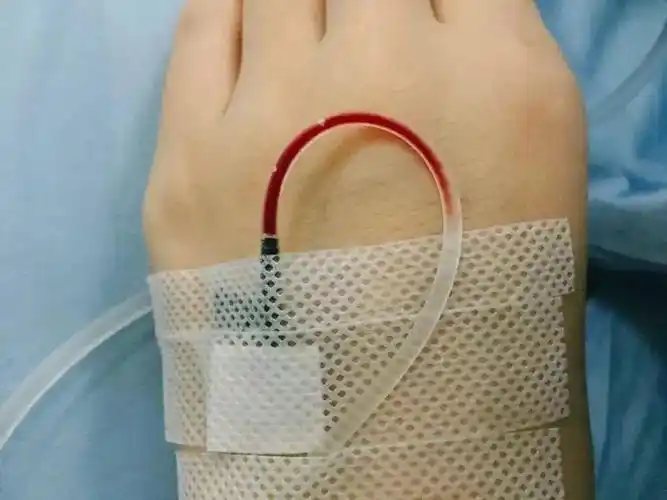 按压止血淤青?打针这些常识你要知道_手机搜狐网