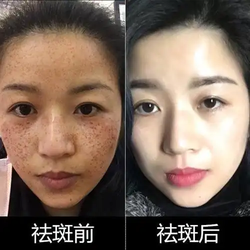 哪种产品淡斑效果好?揭晓淡斑美白效果好的护肤品