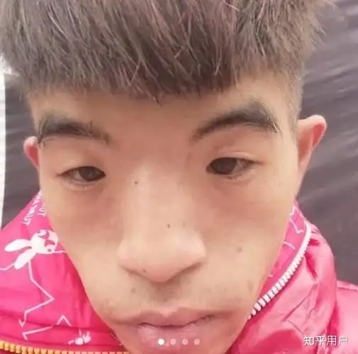 有没有长得丑的男生照片分享一下.我想知道什么样算丑 ?