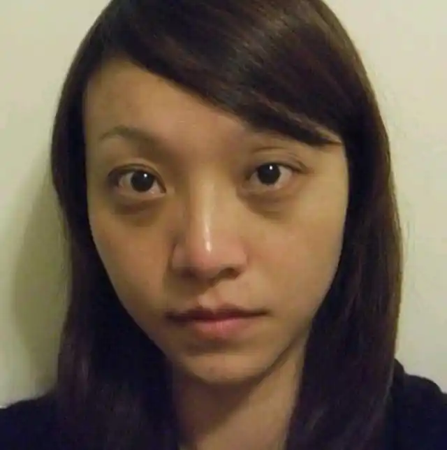 黑眼圈,眼皮浮肿,脂肪颗粒,和哪些原因有关?该如何调理?