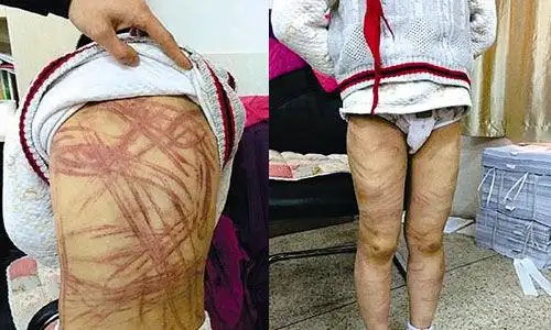 痛心!"虐童案"施暴者75%为亲生父母