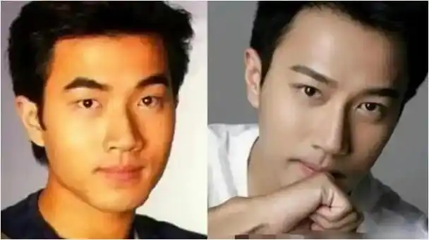 单眼皮|甄子丹|陈学冬|双眼皮手术_网易订阅