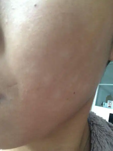 请问我的脸发白的地方是怎么回事?好长