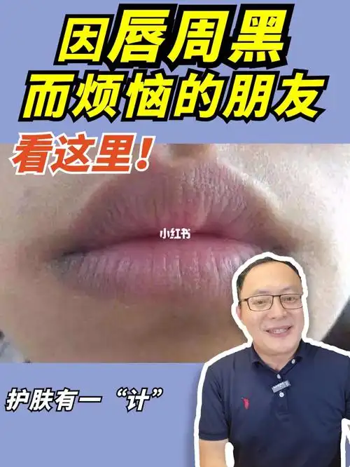 唇周暗沉嘴角发黑如何改善