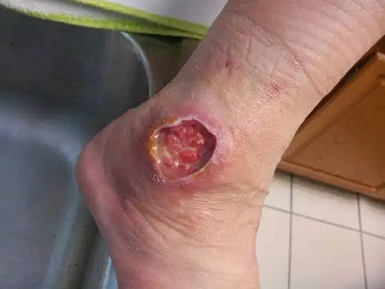 看到这种蜘蛛请拔腿狂奔太恐怖啦