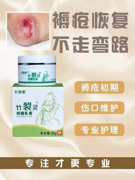 中草药秘方,竹裂灵皮肤乳膏,从婴儿到老人,从头到脚,一个安全 - 抖音