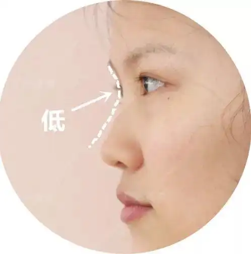 她鼻梁塌鼻头大受不鸟跑去隆鼻了