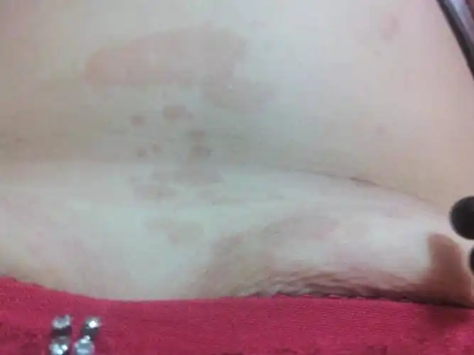 急急急.身上这黑斑是怎么回事?