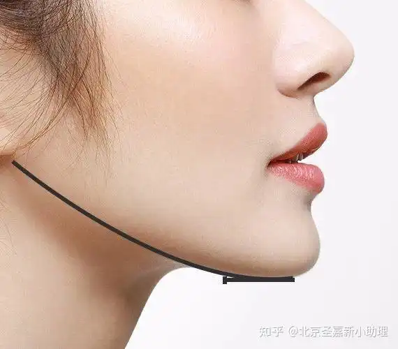 下颌线决定好看程度你的侧脸能打几分