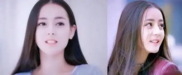 演员烤瓷牙有多可怕嘴凸显老嘴包不住牙演戏没法看